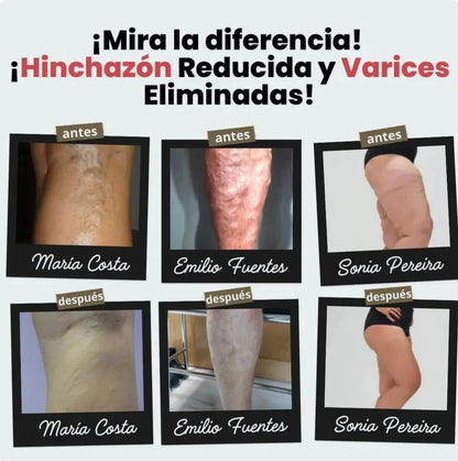 (Paga 1 y Recibe 1 Gratis) Calcetines de Acupresión Antivarices - Talla Universal (Compatible con cualquier tamaño).