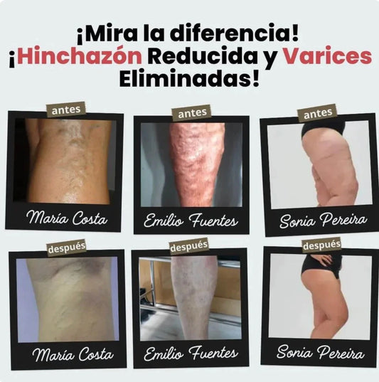 (Paga 1 y Recibe 1 Gratis) Calcetines de Acupresión Antivarices - Talla Universal (Compatible con cualquier tamaño).