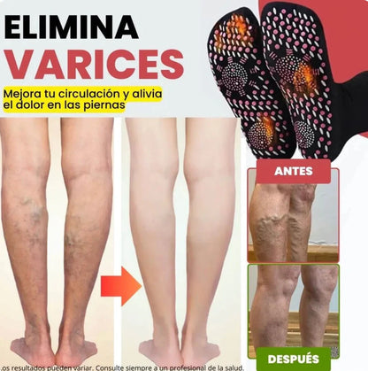 (Paga 1 y Recibe 1 Gratis) Calcetines de Acupresión Antivarices - Talla Universal (Compatible con cualquier tamaño).