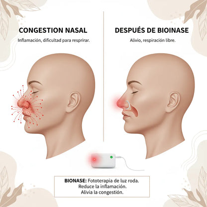 Bionase Fototerapia Nasal