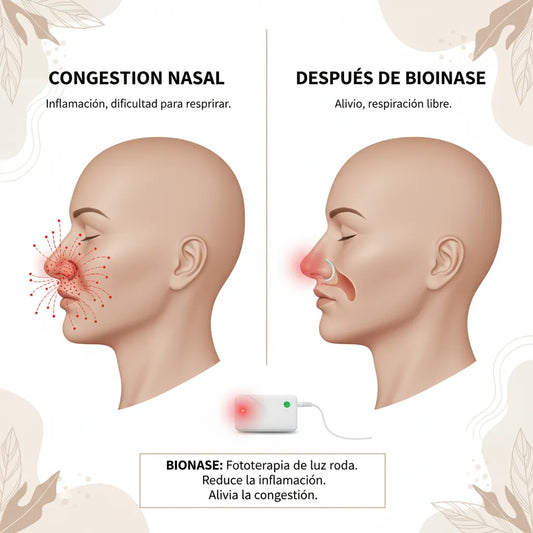 Bionase Fototerapia Nasal
